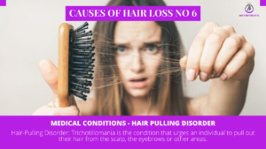 Woman Hair Pull Disorder