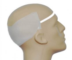 Donor Template Sample as Example for Hair Transplant Protocol and Procedure Donor Template Sample as Example for Hair Transplant Protocol and Procedure